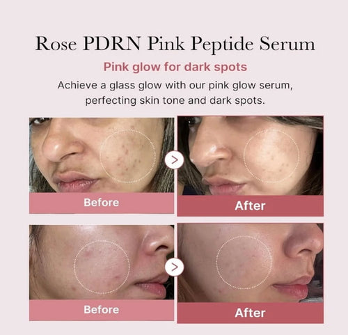  PDRN Pink Peptide Serum
